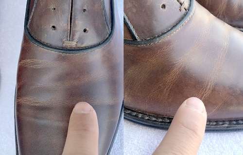 Shoe care problem areas